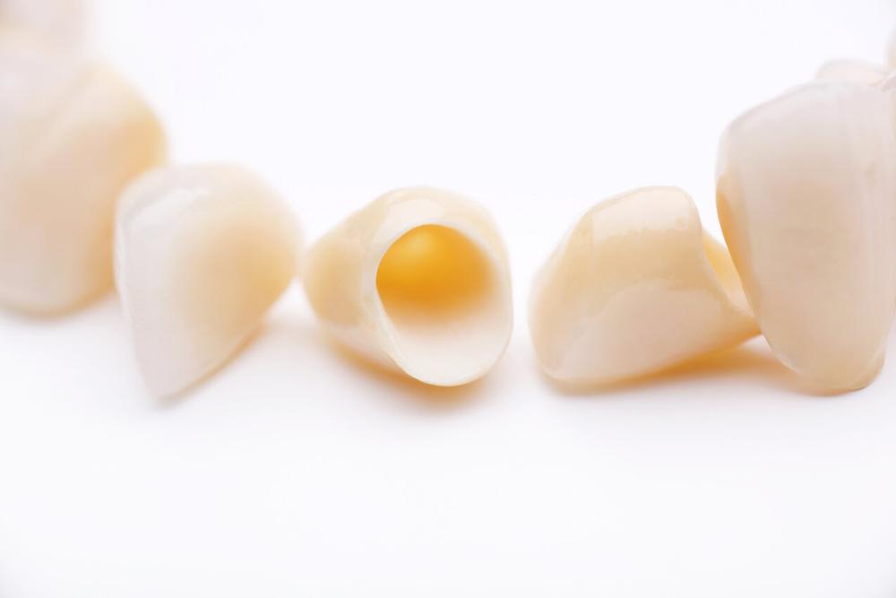 dental crowns in lincoln