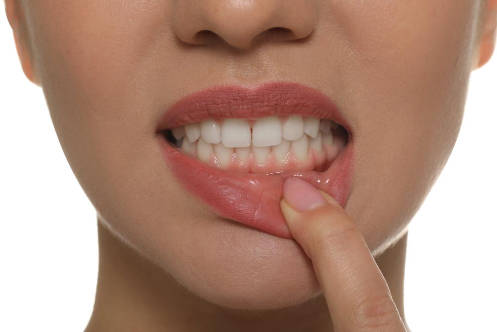 close up of woman pointing to her gums