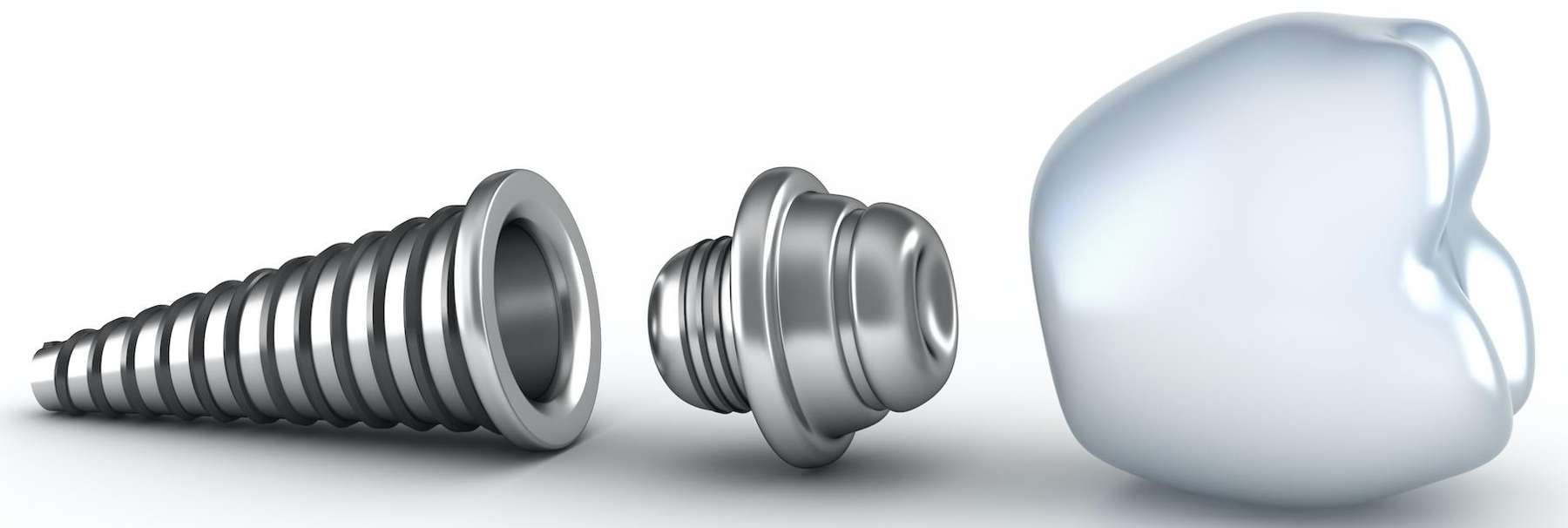 parts of a dental implant